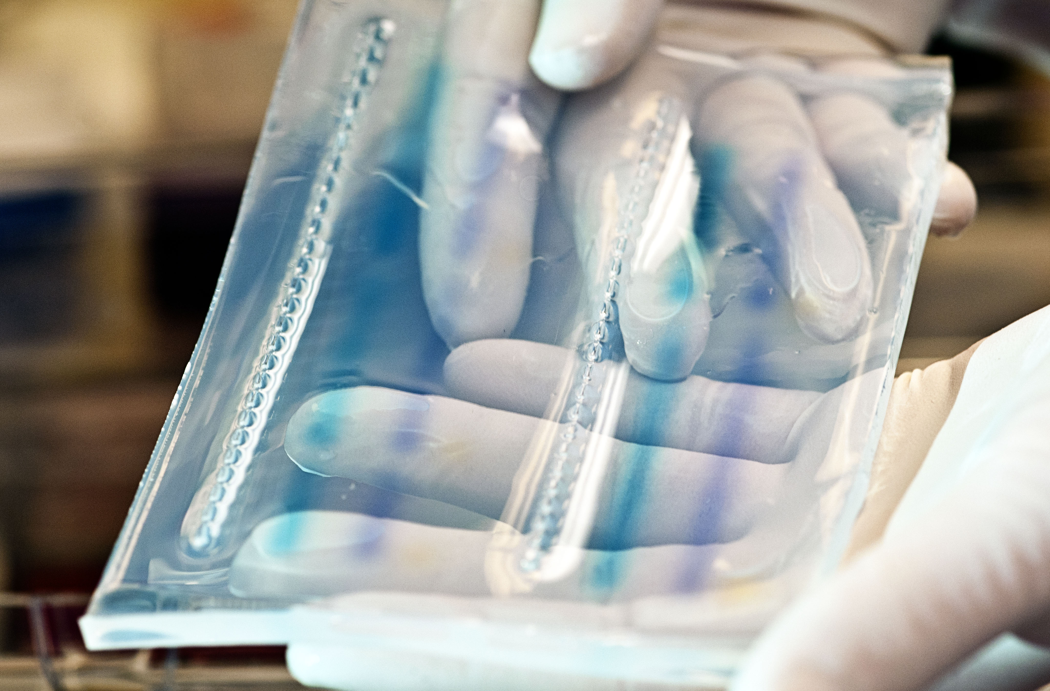 Herausforderungen und Fortschritte bei der Bestimmung der MRD bei soliden Tumoren